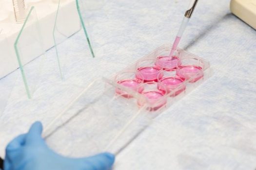Calico AbbVie Anti-Aging Venture