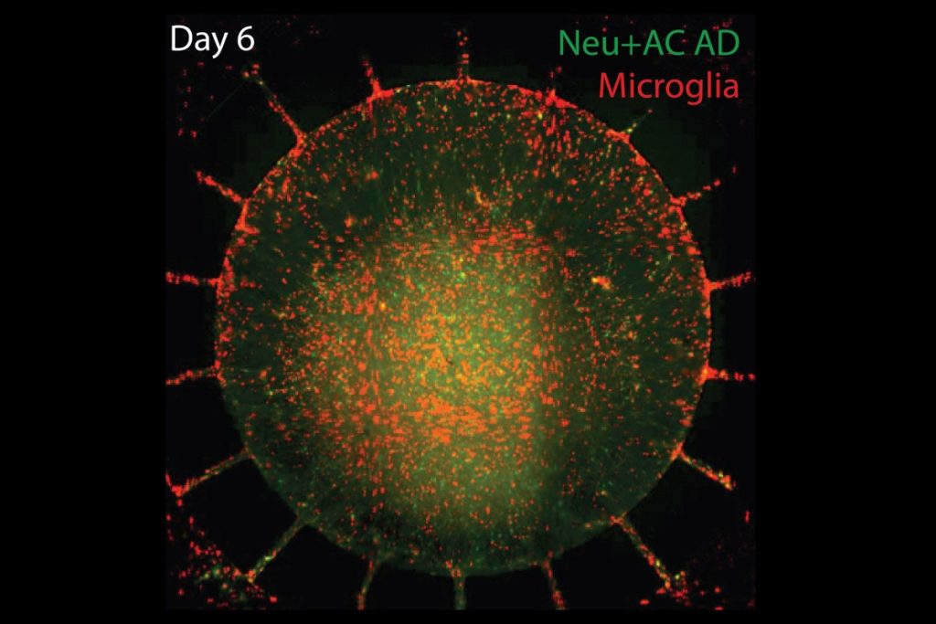 Alzheimer's in a dish