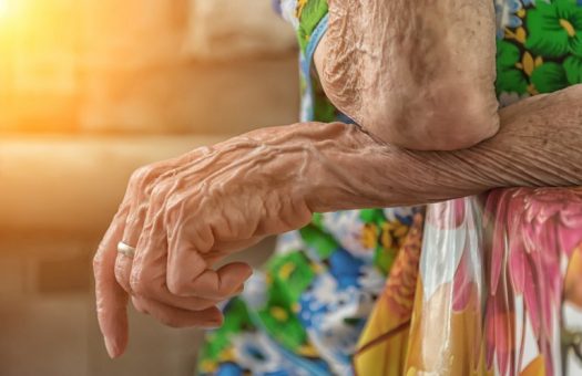 What to Know About Thinning Skin and Easy Bruising Skin